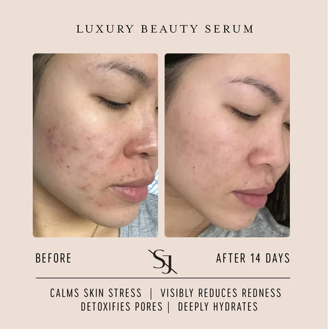 Luxury Beauty Serum