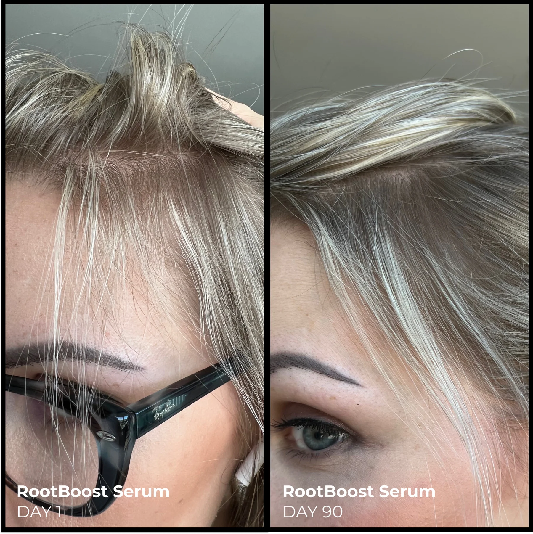 Derma Root Reviews Better Roots ROOTBOOST SERUM – Paradigm Beauty
