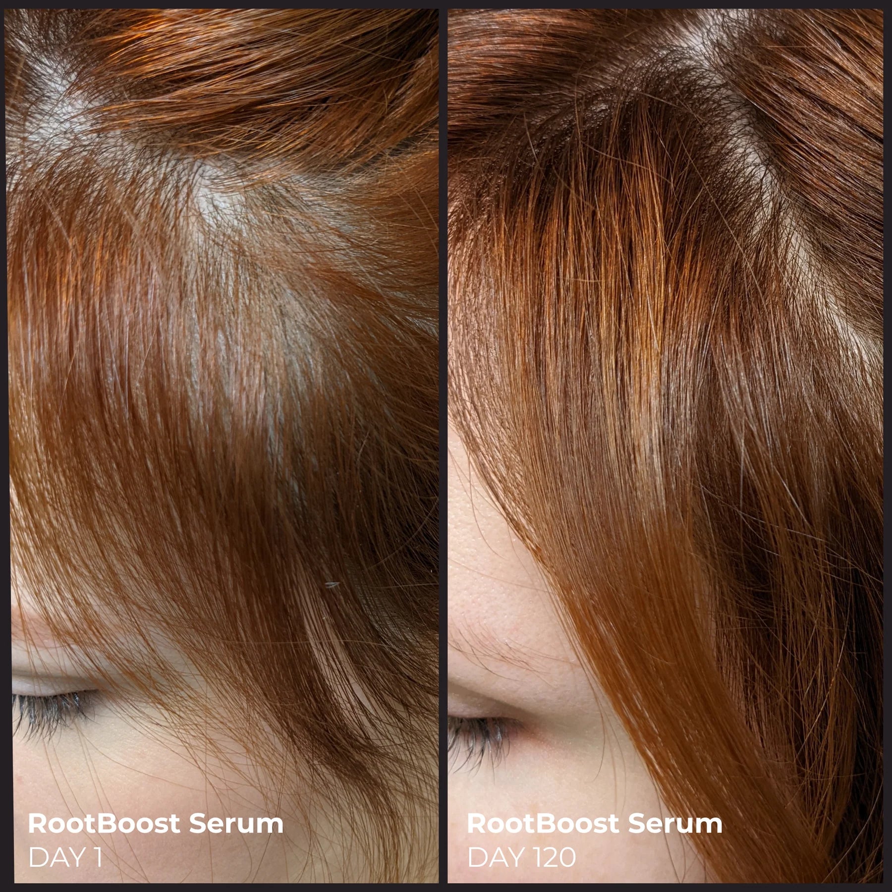 Better Roots ROOTBOOST SERUM